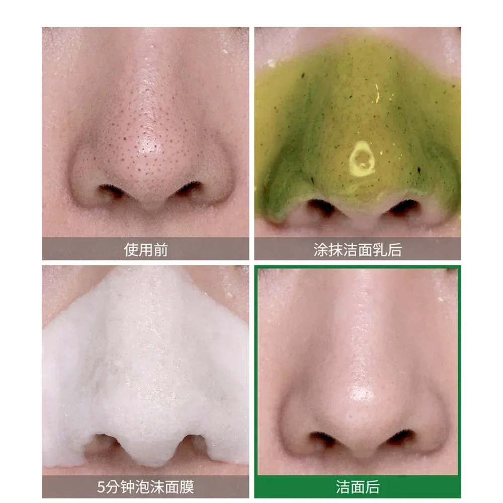 韓国 SOME BY MI バイバイ ブラックヘッド 30デ - Skincare Some By Mi のレビューと価格