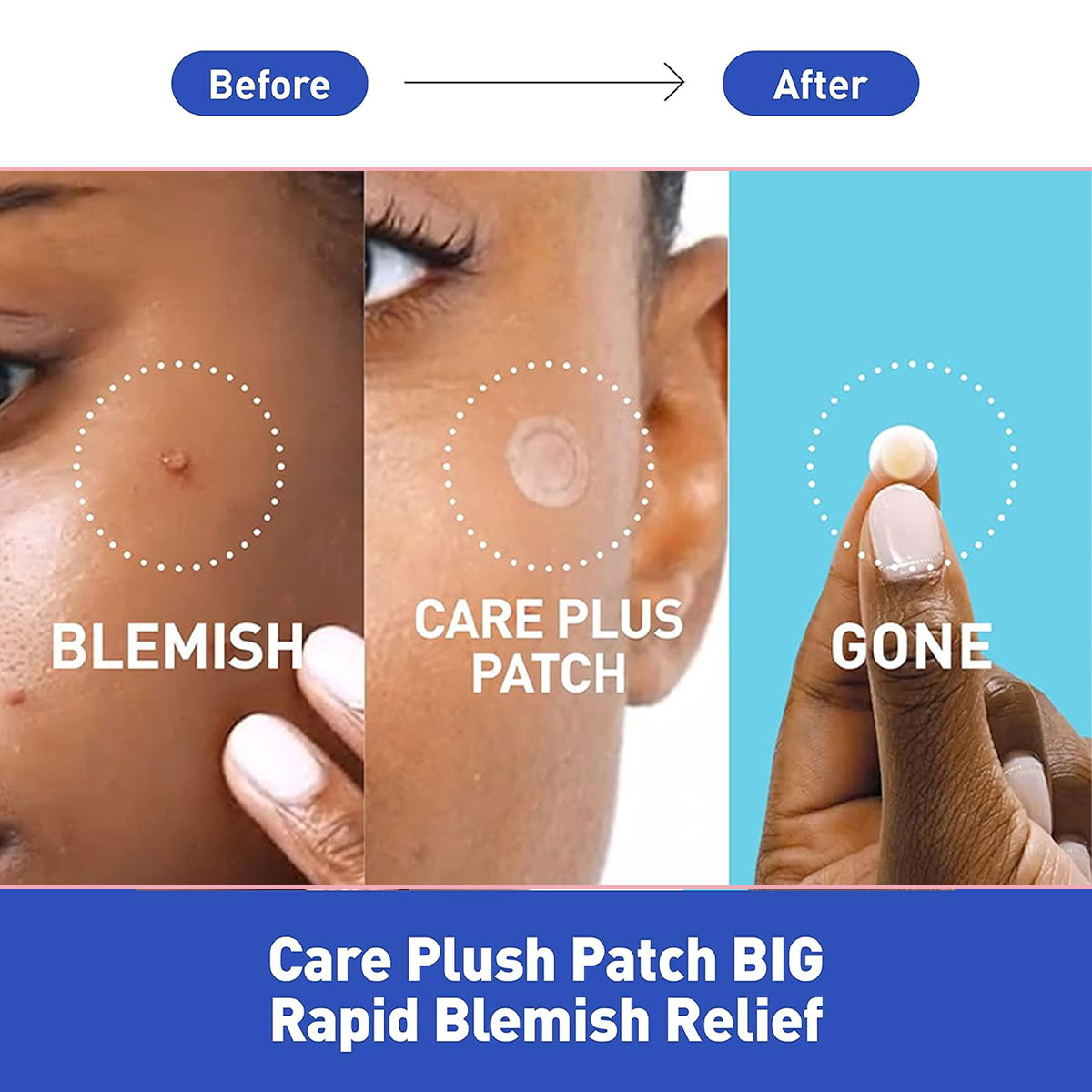 オリーブヤング ケアプラス スポットカバー スポットパッチ、 - Skincare Acne のレビューと価格
