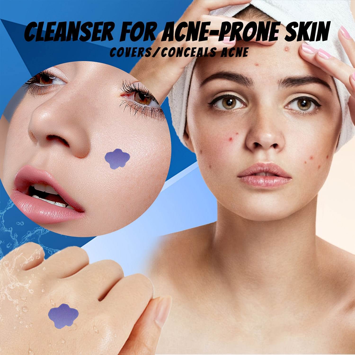 マイクロニードルニキビパッチ 232 個防水目に見えない抗ニ - Skincare Acne のレビューと価格