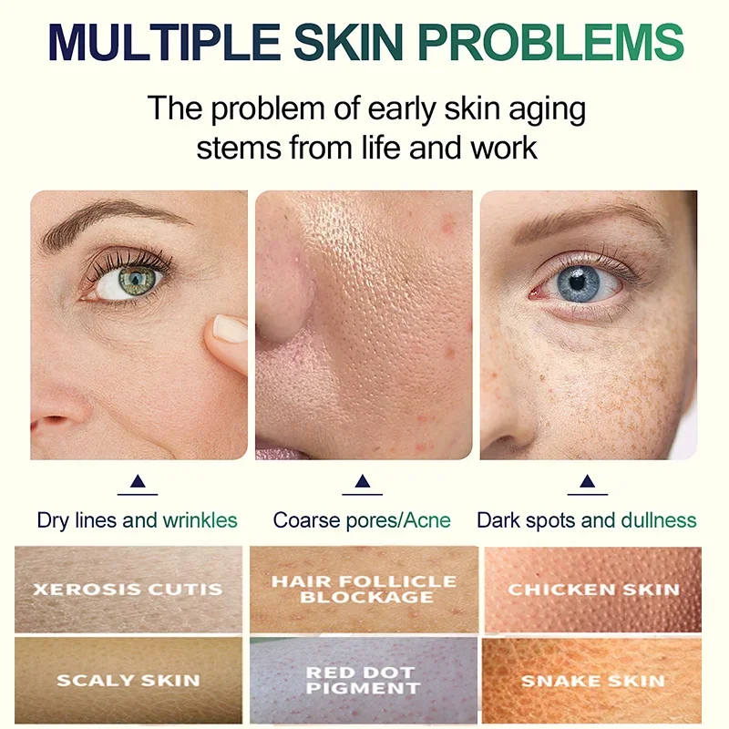 2ND サリチル酸 フェイシャルピール ニュートラライザー  - Salicylic Acid Cleanser のレビューと価格