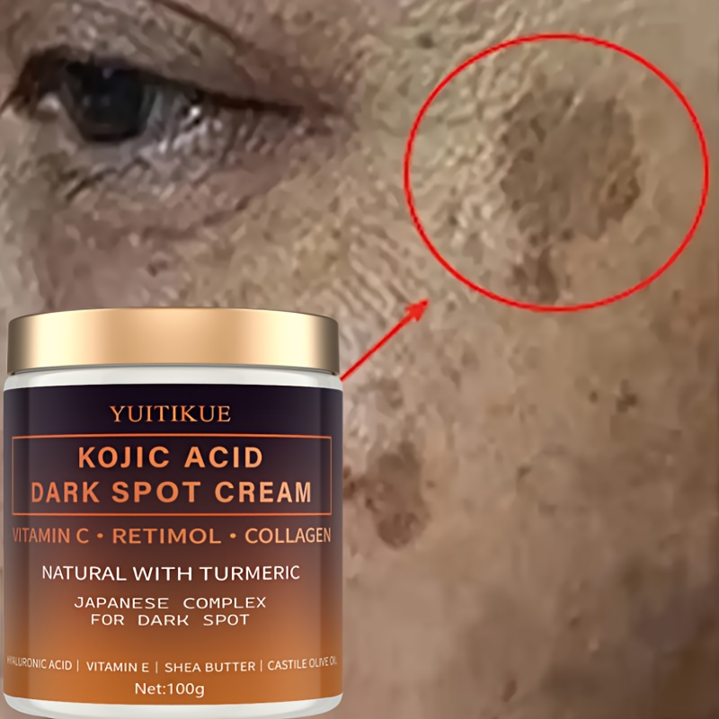 アルブチン美白クリーム、ビタミンC、レチノール、コラーゲン、 - Retinol Vitamin A Cream のレビューと価格